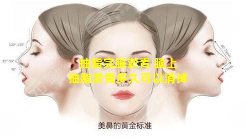 抽脂完腿淤青 腿上抽脂淤青多久可以消掉